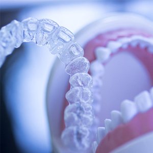 invisalign cost much does teeth false